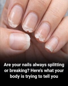 Brittle or fragile nails: what your body is trying to tell you