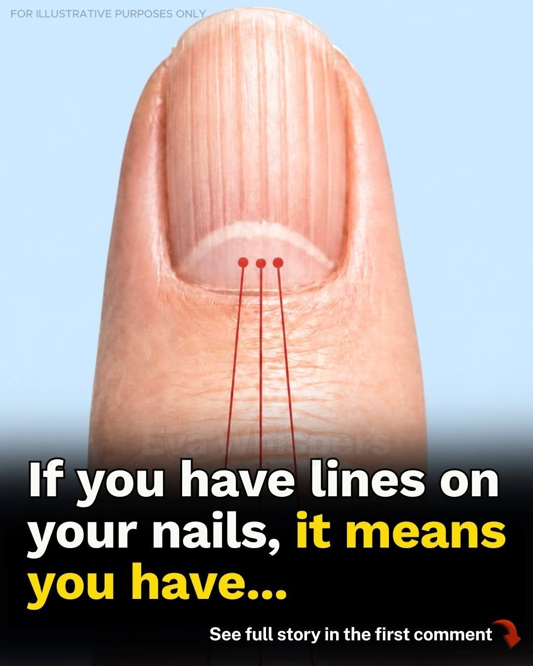 Vertical Lines on…